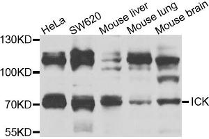 Western blot analysis of extracts of various cell lines, using ICK antibody (ABIN5974764) at 1/1000 dilution. (ICK Antikörper)