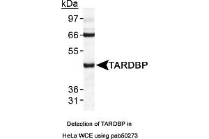 Image no. 1 for anti-TAR DNA Binding Protein (TARDBP) (AA 350-414), (C-Term) antibody (ABIN363582) (TARDBP Antikörper  (C-Term))