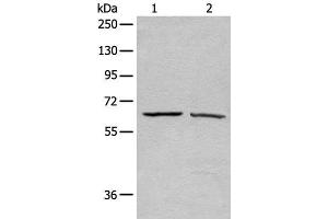 Western blot analysis of A431 and Hela cell lysates using ATAD3A Polyclonal Antibody at dilution of 1:500 (ATAD3A Antikörper)