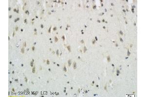 Formalin-fixed and paraffin embedded rat brain tissue labeled with Anti-LC3B/MAP LC3? (MAP1LC3A/B Antikörper  (AA 21-121))
