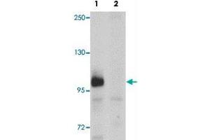 Western blot analysis of ZC3HAV1 in HeLa cell lysate with ZC3HAV1 polyclonal antibody  at 1ug/mL in (1) the absence and (2) the presence of blocking peptide.