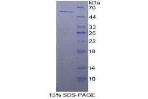 SDS-PAGE (SDS) image for Aldehyde Dehydrogenase 7 Family, Member A1 (ALDH7A1) (AA 28-539) protein (His tag) (ABIN1078763) (ALDH7A1 Protein (AA 28-539) (His tag))