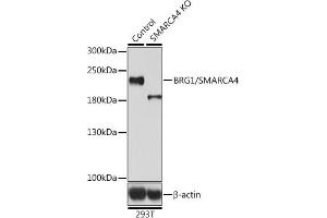 Western blot analysis of extracts from normal (control) and BRG1/BRG1/SM knockout (KO) 293T cells, using BRG1/BRG1/SM antibody (ABIN6133730, ABIN6148100, ABIN6148101 and ABIN7101348) at 1:500 dilution. (SMARCA4 Antikörper  (AA 30-130))