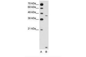 Image no. 2 for anti-Solute Carrier Family 46, Member 3 (SLC46A3) (N-Term) antibody (ABIN205029) (SLC46A3 Antikörper  (N-Term))
