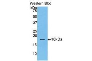 Western Blotting (WB) image for anti-Keratin 6A (KRT6A) (AA 323-461) antibody (ABIN1176074) (KRT6A Antikörper  (AA 323-461))
