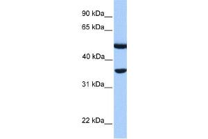 Western Blotting (WB) image for anti-DnaJ (Hsp40) Homolog, Subfamily B, Member 6 (DNAJB6) antibody (ABIN2459535) (DNAJB6 Antikörper)
