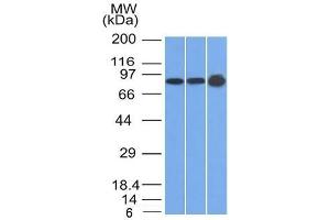 Western Blot of U87, HeLa and A431 cell lysates using Plakophilin-1 Mouse Monoclonal Antibody (10B2) (Plakophilin 1 Antikörper  (N-Term))