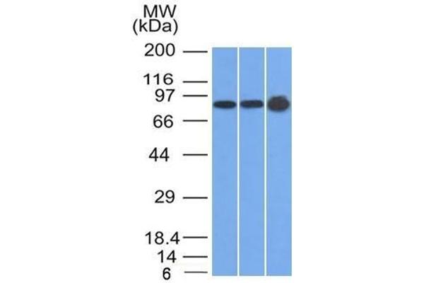 Plakophilin 1 Antikörper  (N-Term)