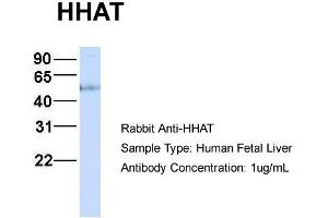 Host:  Rabbit  Target Name:  HHAT  Sample Type:  Human Fetal Liver  Antibody Dilution:  1. (HHAT Antikörper  (N-Term))