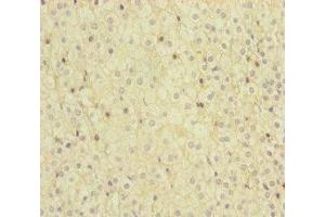 Immunohistochemistry (IHC) image for anti-Methylmalonic Aciduria (Cobalamin Deficiency) CblC Type, with Homocystinuria (MMACHC) (AA 63-282) antibody (ABIN7159656)