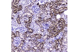 IHC analysis of CES1 using anti-CES1 antibody . (CES1 Antikörper  (AA 99-206))