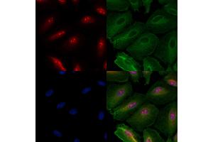 ABIN6260295 and ABIN6279783 staining  cells by IF/ICC. (BMS1 Antikörper  (C-Term))