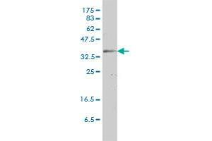 GJB3 monoclonal antibody (M01), clone 3B4-1B3 Western Blot analysis of GJB3 expression in HeLa . (Connexin 31 Antikörper  (AA 1-270))