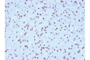 Formalin-fixed, paraffin-embedded human Cerebellum stained with OLIG2 Mouse Monoclonal Antibody (OLIG2/2400).