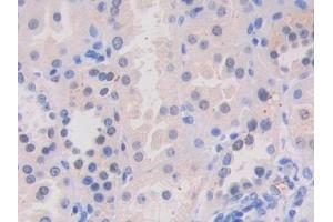Detection of VAV3 in Human Kidney Tissue using Polyclonal Antibody to Vav 3 Oncogene (VAV3)