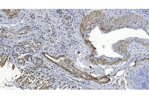 IHC analysis of Alpha B Crystallin/CRYAB using anti-Alpha B Crystallin/CRYAB antibody (ABIN7601209). (CRYAB Antikörper  (AA 30-151))