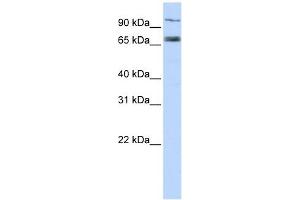 TAP1 antibody used at 1 ug/ml to detect target protein. (TAP1 Antikörper)
