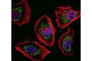 Fluorescent confocal image of HeLa cells stained with SOX4 antibody. (SOX4 Antikörper  (AA 86-114))