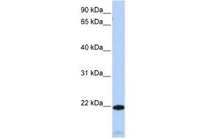 RGS5 antibody used at 1 ug/ml to detect target protein.