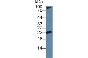 Western Blot; Sample: Mouse Cerebrum lysate; Primary Ab: 1µg/ml Rabbit Anti-Mouse FTL Antibody Second Ab: 0. (FTL Antikörper  (AA 5-183))