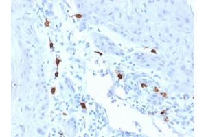 Formalin-fixed, paraffin-embedded human Skin stained with Tryptase Mouse Monoclonal Antibody (TPSAB1/1963). (TPSAB1 Antikörper  (AA 115-233))