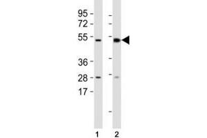 Western blot testing of Mlkl antibody at 1:1000 dilution and mouse samples: (1) lung, (2) spleen lysate; Predicted size: 54 kDa. (MLKL Antikörper  (AA 444-472))