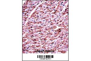 DHRS7C Antibody immunohistochemistry analysis in formalin fixed and paraffin embedded human heart tissue followed by peroxidase conjugation of the secondary antibody and DAB staining. (DHRS7C Antikörper  (AA 116-145))