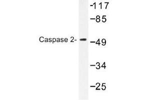 Image no. 1 for anti-Caspase 2, Apoptosis-Related Cysteine Peptidase (CASP2) antibody (ABIN317792) (Caspase 2 Antikörper)