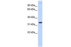 Image no. 1 for anti-Acidic (Leucine-Rich) Nuclear phosphoprotein 32 Family, Member B (ANP32B) (AA 36-85) antibody (ABIN6741124) (ANP32B Antikörper  (AA 36-85))
