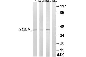 Western blot analysis of extracts from Jurkat cells, HepG2 cells and HeLa cells, using SGCA antibody. (SGCA Antikörper  (Internal Region))