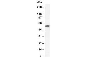 Western blot testing of human testis lysate with KATNAL2 antibody at 0. (KATNAL2 Antikörper)