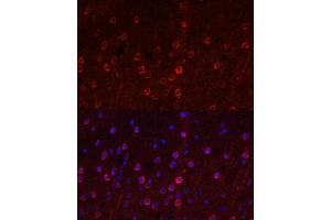 Immunofluorescence analysis of rat brain using SLC1 antibody (ABIN6131630, ABIN6147868, ABIN6147869 and ABIN6219899) at dilution of 1:100. (SLC1A1 Antikörper  (AA 430-524))