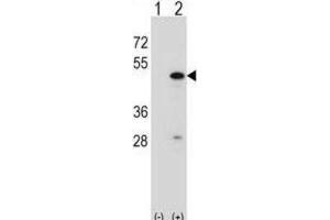 Western Blotting (WB) image for anti-RNA Binding Motif Protein 22 (RBM22) antibody (ABIN2998337) (RBM22 Antikörper)