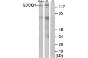 Western blot analysis of extracts from HeLa/Jurkat cells, using SDCG1 Antibody. (NEMF Antikörper  (AA 881-930))
