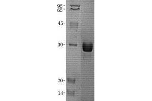 Validation with Western Blot (ZMYND19 Protein (His tag))