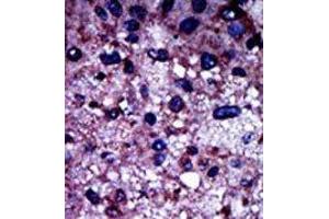 Image no. 2 for anti-phosphofructokinase, Muscle (PFKM) (N-Term) antibody (ABIN360632)