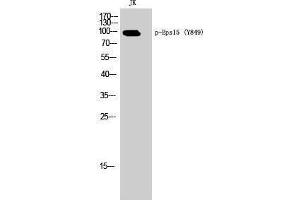 EPS15 Antikörper  (pTyr849)
