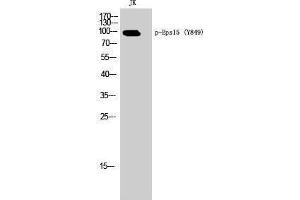 Western Blotting (WB) image for anti-Epidermal Growth Factor Receptor Pathway Substrate 15 (EPS15) (pTyr849) antibody (ABIN3182362) (EPS15 Antikörper  (pTyr849))