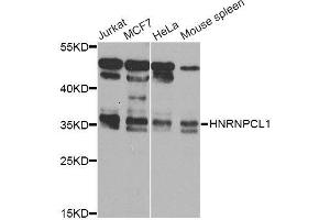 Western blot analysis of extracts of various cell lines, using HNRNPCL1 Antibody (ABIN5995850) at 1/1000 dilution. (HNRNPCL1 Antikörper)