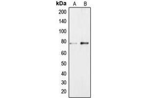 Western blot analysis of BRF1 expression in Jurkat (A), NIH3T3 (B) whole cell lysates. (BRF1 Antikörper  (Center))