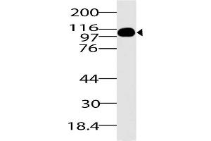 Image no. 1 for anti-DEAD (Asp-Glu-Ala-Asp) Box Polypeptide 58 (DDX58) (AA 1-220) antibody (ABIN5027274) (DDX58 Antikörper  (AA 1-220))