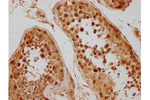 IHC image of ABIN7152321 diluted at 1:300 and staining in paraffin-embedded human testis tissue performed on a Leica BondTM system. (Exportin 2 Antikörper  (AA 713-971))