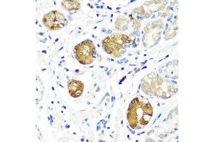 Immunohistochemistry of paraffin-embedded human stomach using SGSH antibody at dilution of 1:100 (40x lens). (SGSH Antikörper)