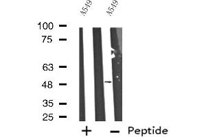 Western blot analysis of extracts from A549 cells, using Cytochrome P450 17A1 antibody. (CYP17A1 Antikörper  (Internal Region))