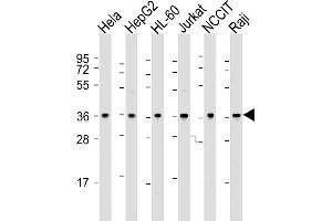 All lanes : Anti-OGG1 Antibody (C-term) at 1:2000 dilution Lane 1: Hela whole cell lysate Lane 2: HepG2 whole cell lysate Lane 3: HL-60 whole cell lysate Lane 4: Jurkat whole cell lysate Lane 5: NCCIT whole cell lysate Lane 6: Raji whole cell lysate Lysates/proteins at 20 μg per lane. (OGG1 Antikörper  (C-Term))