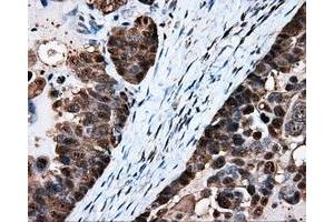 Immunohistochemical staining of paraffin-embedded Kidney tissue using anti-HSPA1A mouse monoclonal antibody. (HSP70 1A Antikörper)