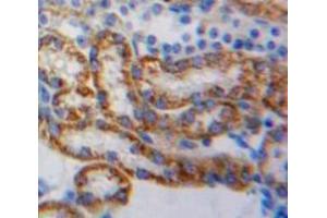 Immunohistochemistry (IHC) image for anti-NADH Dehydrogenase (Ubiquinone) 1, alpha/beta Subcomplex, 1, 8kDa (NDUFAB1) (AA 3-129) antibody (ABIN1857868)
