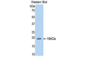 Western Blotting (WB) image for anti-serpin Peptidase Inhibitor, Clade A (Alpha-1 Antiproteinase, Antitrypsin), Member 6 (SERPINA6) (AA 106-255) antibody (ABIN1858273) (SERPINA6 Antikörper  (AA 106-255))