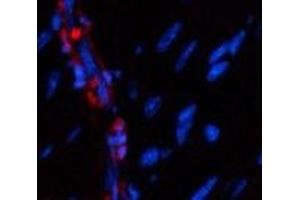 Immunofluorescence analysis of Mouse heart tissue using α-SMA Polyclonal Antibody at dilution of 1:200. (alpha-SMA Antikörper)