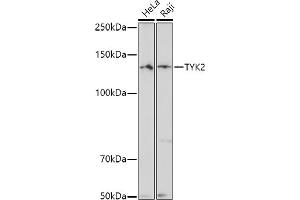Western blot analysis of extracts of various cell lines, using TYK2 antibody (ABIN3022987, ABIN3022988, ABIN3022989 and ABIN6219333) at 1:500 dilution. (TYK2 Antikörper  (AA 750-850))
